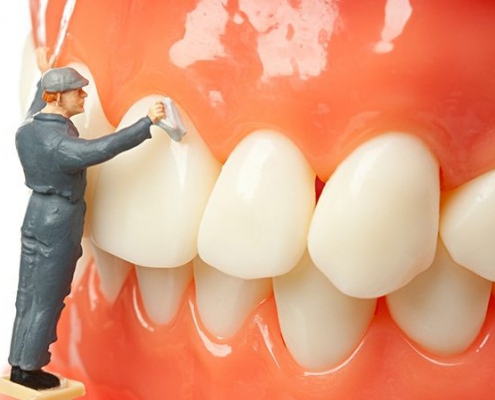 جرم گیری دندان ها در کلینیک دندان پزشکی تبسم مهر