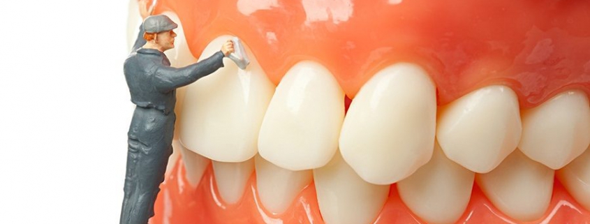 جرم گیری دندان ها در کلینیک دندان پزشکی تبسم مهر